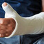 PLAYING CS2 WITH BROKEN HAND