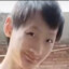 扣扣皮炎闻闻手