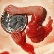 ICannibal