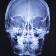 skull