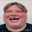 DoģikPeek P1mple