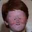 Suicidal Ginger