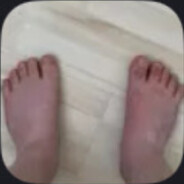 Ugly fat ginger amongus feet