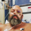 Big Lenny at the ER