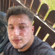 Ｃｙｔｙｒｅｇｕ