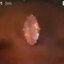 Lil Uzi Vert&#039;s Forehead Diamond