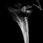 SCP-049