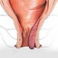 HEMORRHOIDS