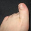 left toe