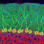 Cerebellum diff