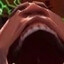 Pain