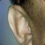 Kim Jong-il&#039;s Right Ear