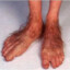 hairy hobbit toes