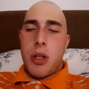 ☺ Bald & Beautiful ☺