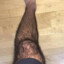 leg hair