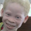 ALBINOS ARE A GLICH