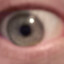 the eye