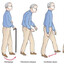 Fixing the Gait