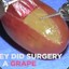 They Did Surgery On A Grape