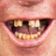 EU Teeth