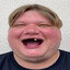 pimpuś CSGOSKINS