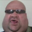 Smegma