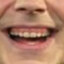 Jack White&#039;s teeth