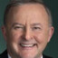 Prime Minister Anthony Albanese