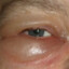 Eye Sack