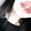 kissxo