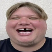 CASE.GIFTkokosanek - steam id 76561199514615891