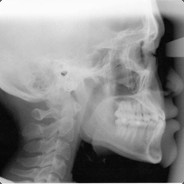 pHaDeXoNeR801 - steam id 76561197965746572