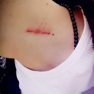 让暴风雨再来一次