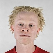 Heelsoverhead