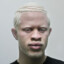 Black Albino RIZZ