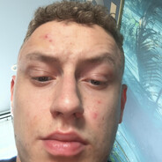 ziymmmmmmmmmmmmmmmx skins.army