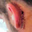 Burn &quot;EAR HACKS&quot;