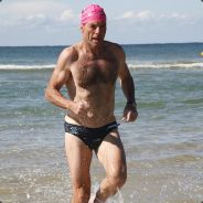 Tony Abbott's Chest Hair