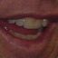 John Elway&#039;s Teeth