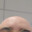 My friend's bald head