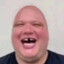 chinardown