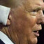 Donald Trump&#039;s damaged ear