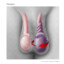 testicular