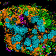 BiofilmBrio