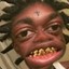 KODAK BLACK