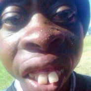 APE