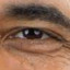 Obama&#039;s left eyeball