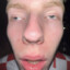 Nalle18