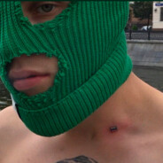 她说下面是晒黑的