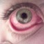 Eyes_So_Sick